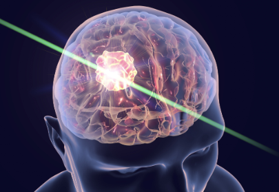 術(shù)中成像用藍(lán)寶石